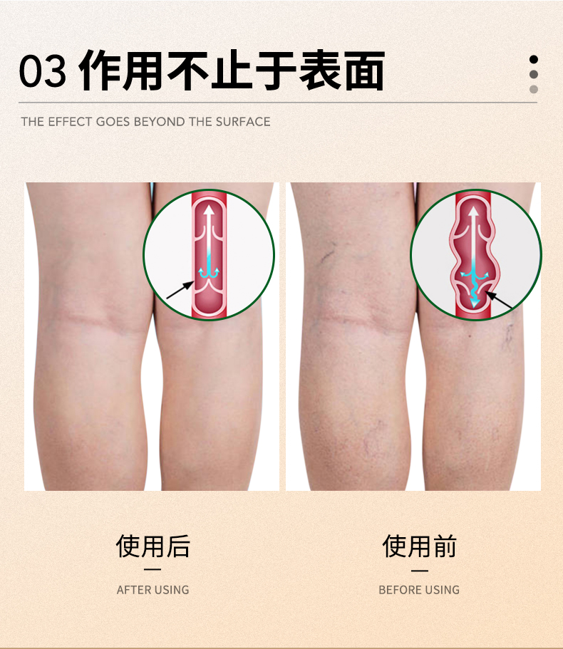 红叶按摩膏_10.jpg